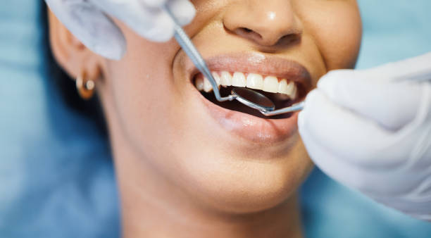 Best Emergency Denture Repair in Grants Pass, OR